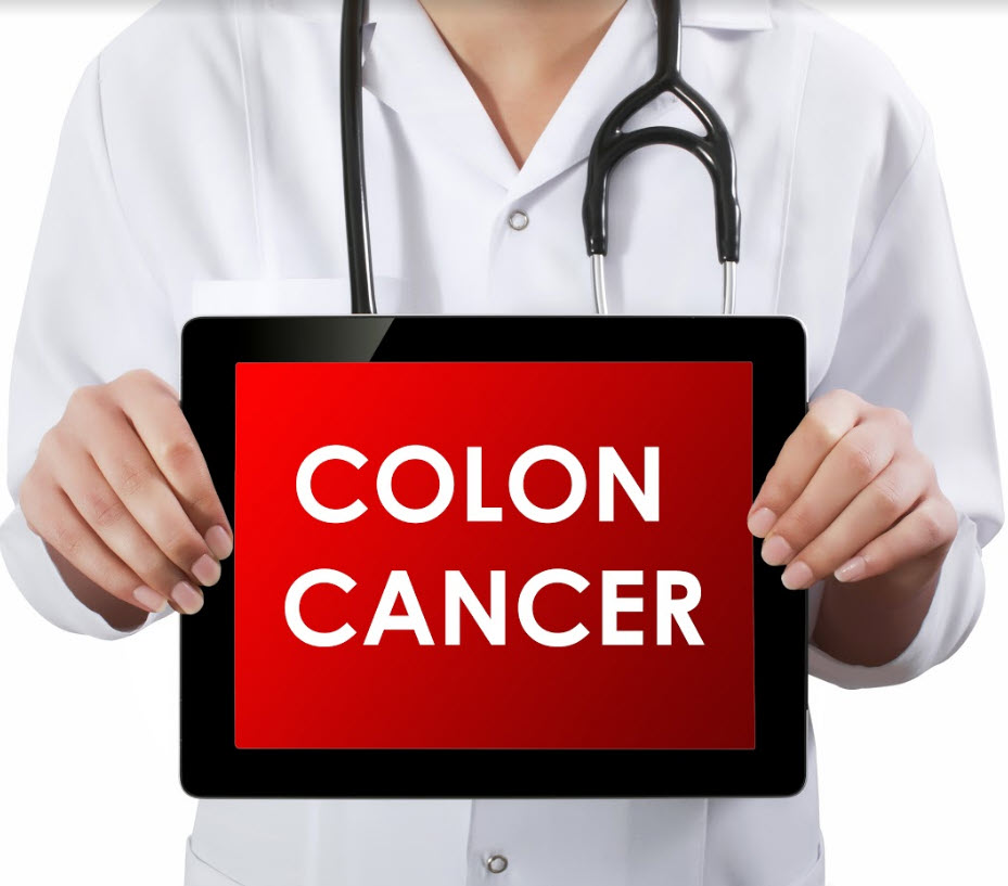 ACM Colon Cancer